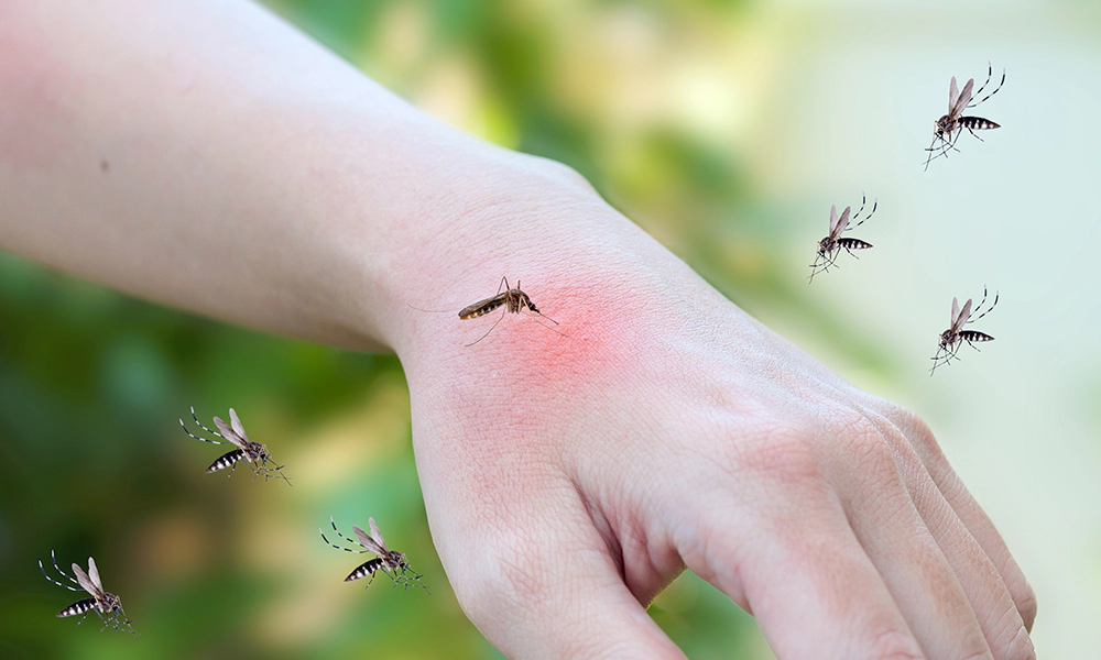 A close-up of a hand with mosquitoes biting, showing the redness caused by mosquito bites.